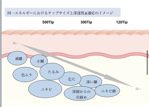 C68DE7C5-C4F4-4EBE-866C-18512B39BF49_1_201_a