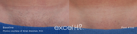 excel_HR_Hair_4