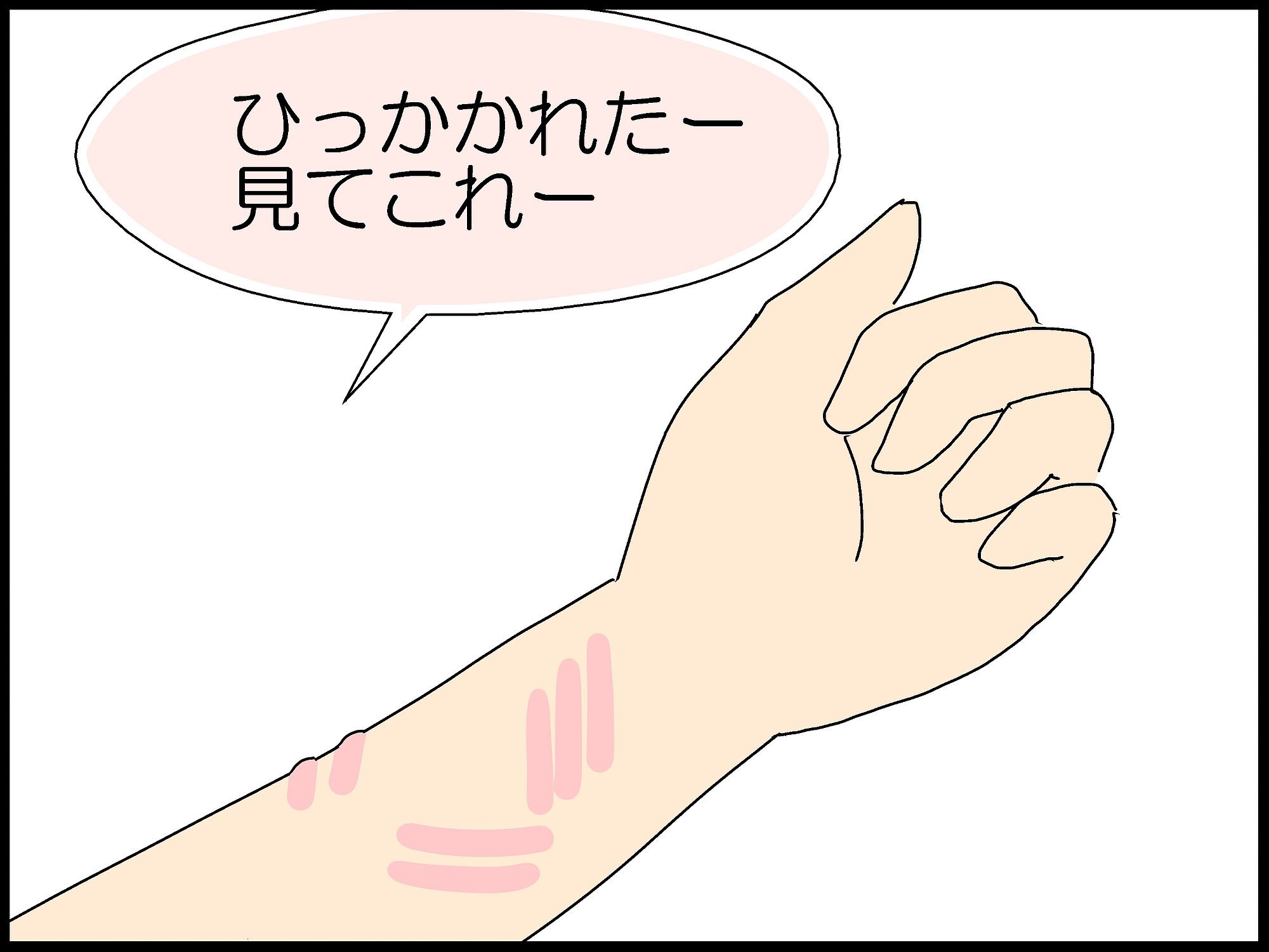 猫の爪痕と蚊の話 Moroの家族と ハンドメイドと Moroオフィシャルブログ Powered By ライブドアブログ