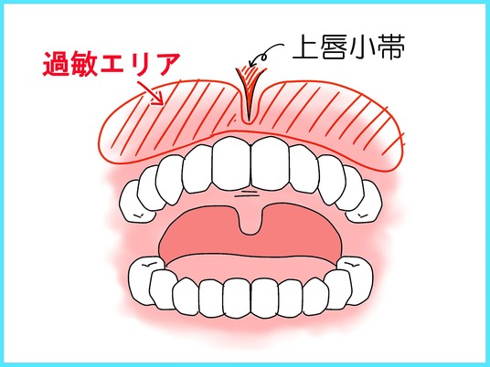 ブログ0004