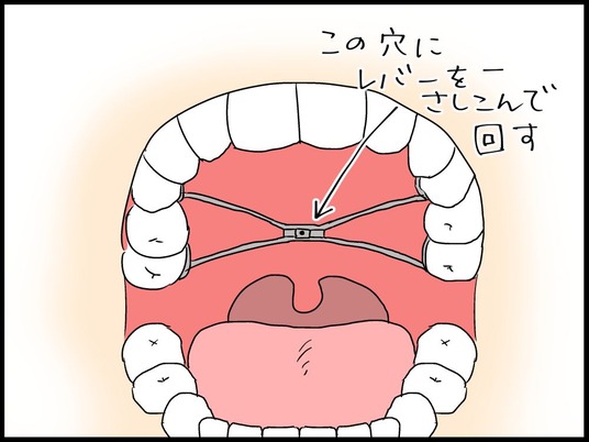 ブログ0007