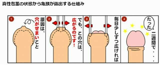 俺も包茎だったんです もう包茎で悩むな 男には人には言えない悩みがたくさんある 俺も包茎だったんです もう包茎で悩むな 男には人には言えない悩みがたくさんある