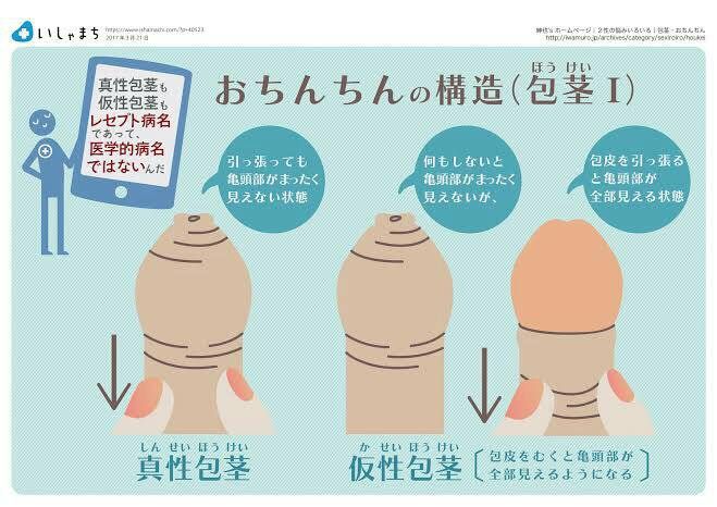 包茎を自分でムクのが怖い人には もう包茎で悩むな 男には人には言えない悩みがたくさんある 包茎を自分でムクのが怖い人には もう包茎で悩むな 男には人には言えない悩みがたくさんある