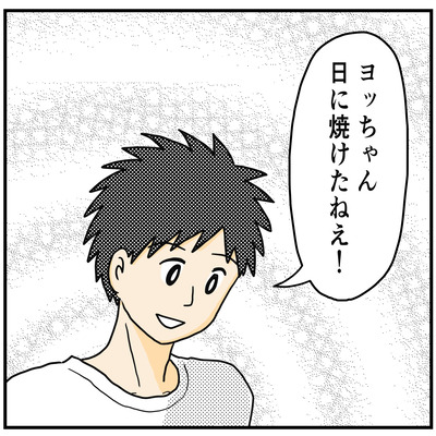 589 妹の日焼け2