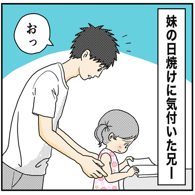589 妹の日焼け1