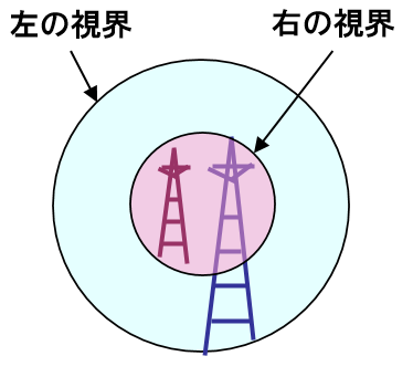 平行器視界1