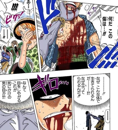 Naruto のイルカ先生 この傷でも普通に喋り出す もゆげん 萌癒元