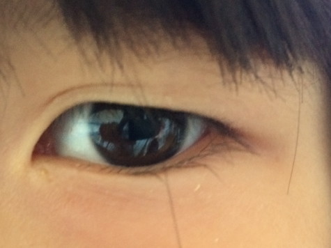 逆まつげ さかまつげ の健診結果をもらってきたー ウチの娘の社長っぷり