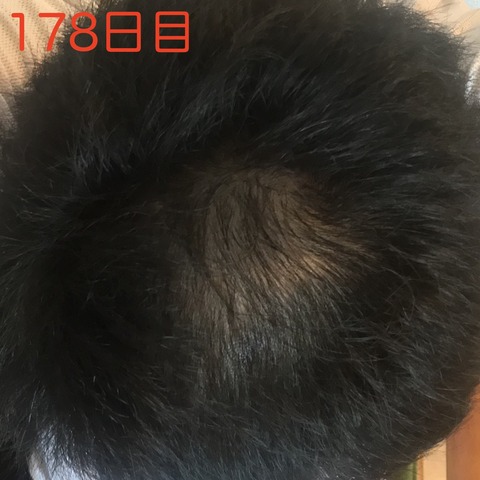 fullsizeoutput_a32