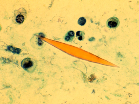 001 細胞画像 喀痰 今日の臨検