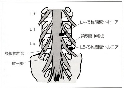 神経ブロック