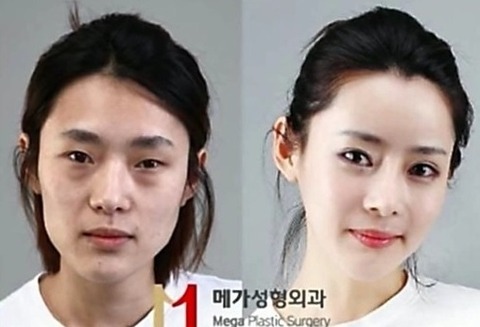 整形-韓国人-性格-特徴