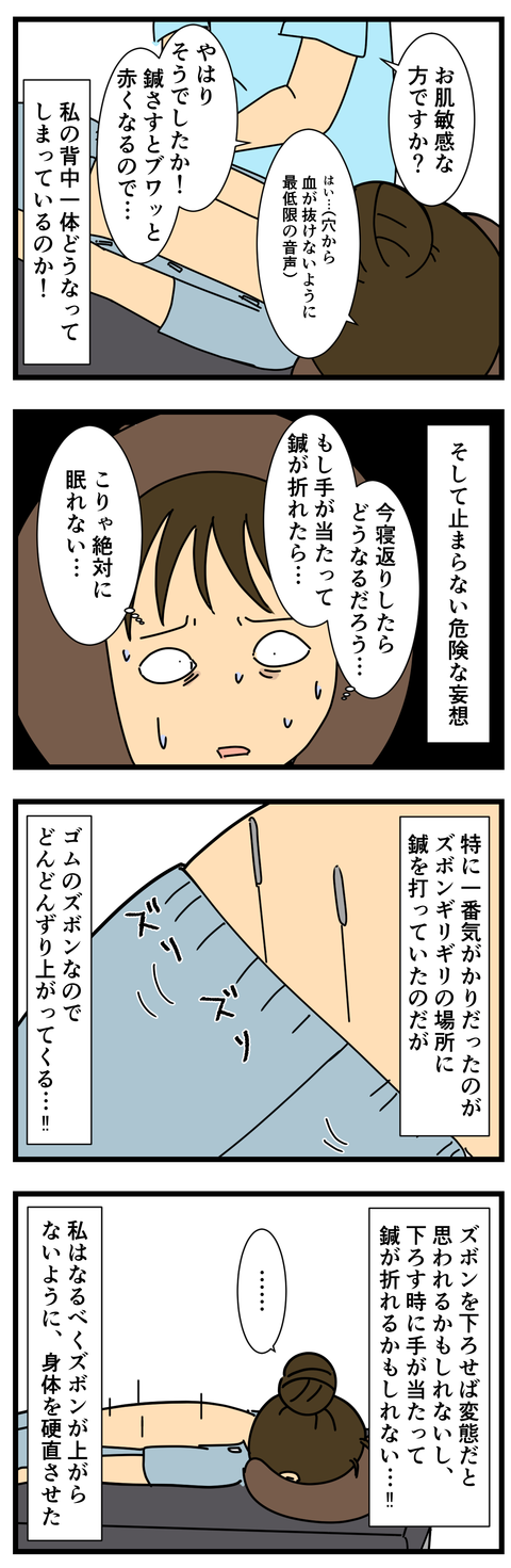 鍼治療、正直無茶苦茶怖い (3)