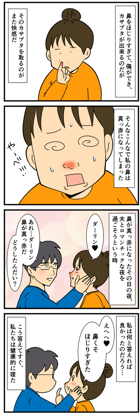 今左の鼻がやけにデカい理由 何の因果か 漫画オタ外人と結婚してしまった Powered By ライブドアブログ