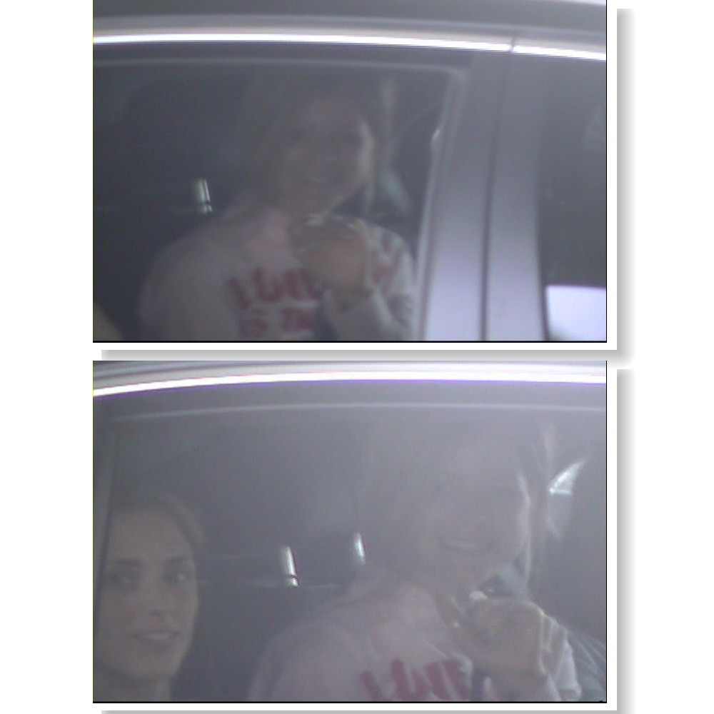 ヒアルロン酸日記 アヴリル ラヴィーン