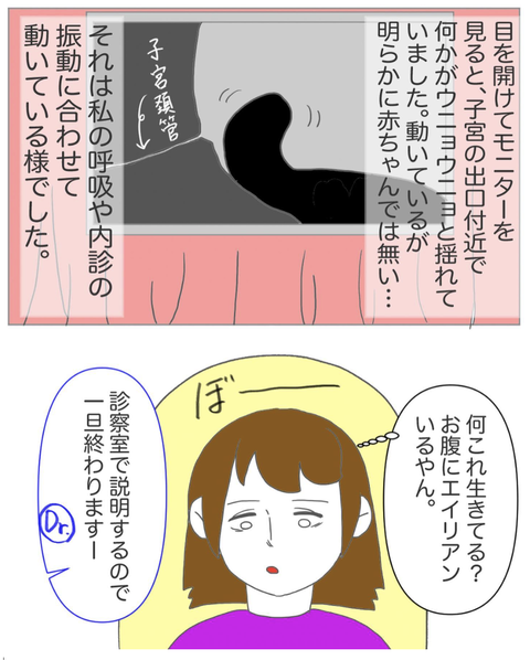 スクリーンショット 2023-08-01 11.59.03