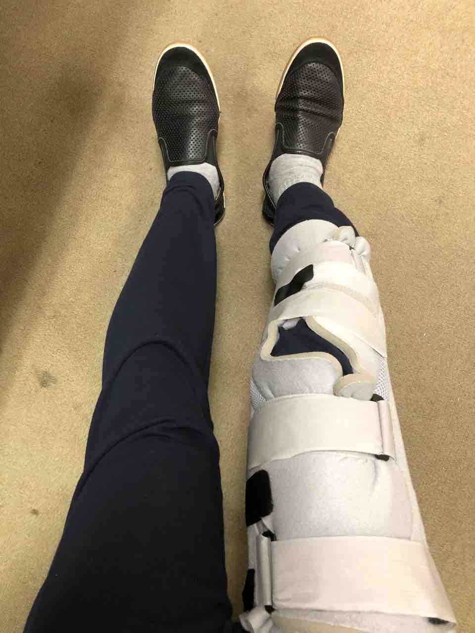 膝蓋骨骨折の記録 膝蓋骨骨折の記録