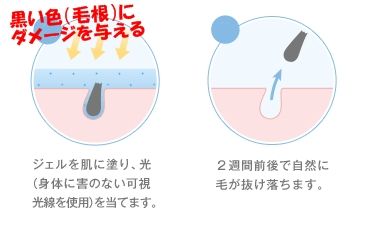 陰毛を白髪染めする話しを聞いたので アンダーヘアは脱毛するのもいいかも ミュゼvioハイジニーナ口コミブログ 脱毛効果 40代美blog