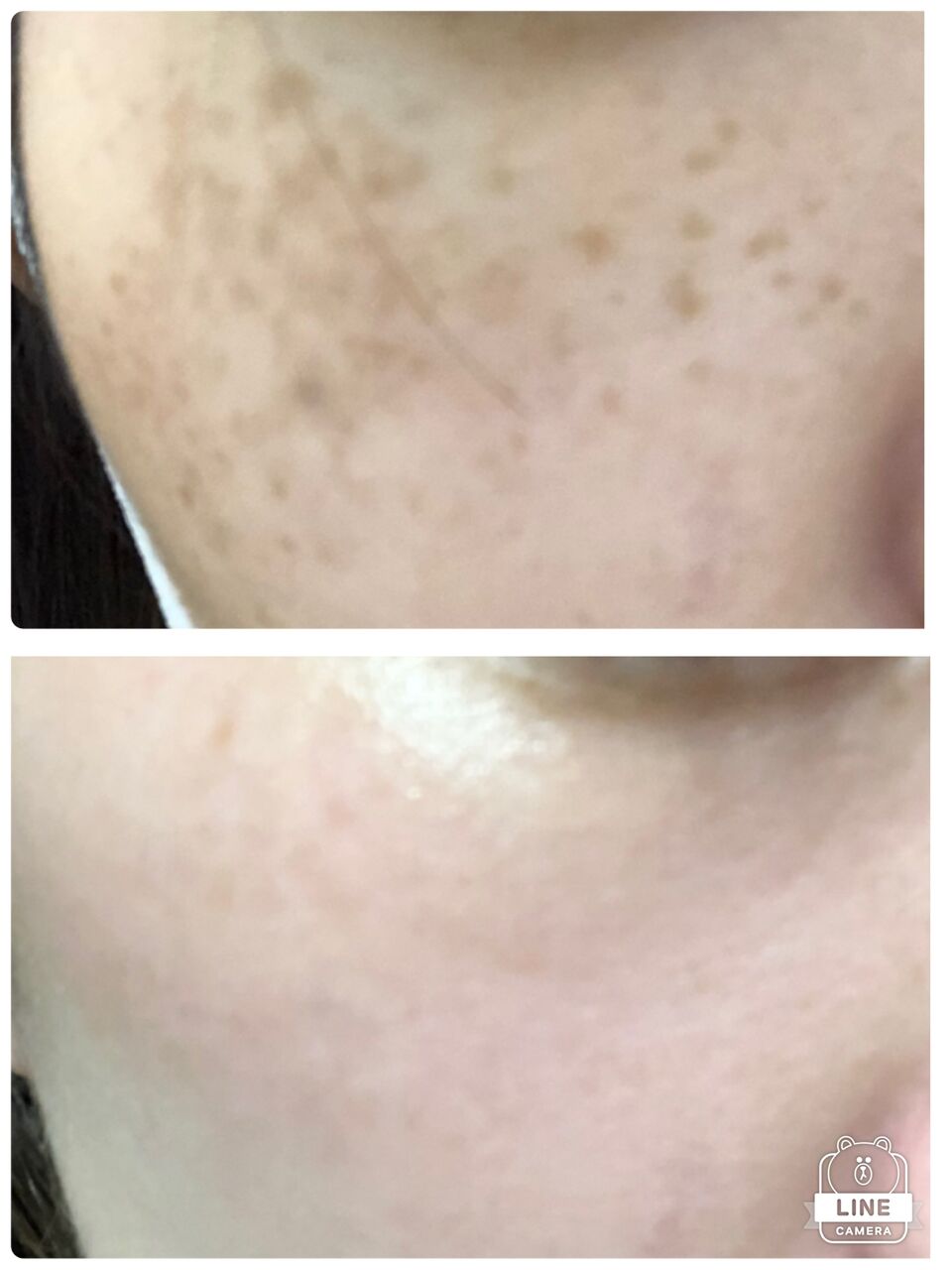 シミそばかすを消す方法 M