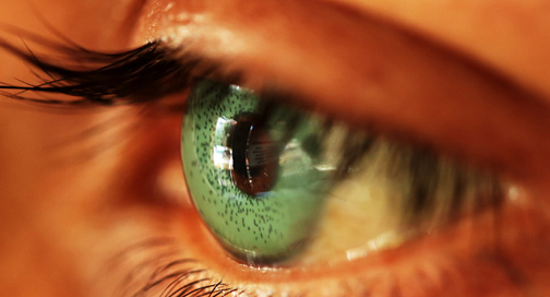 目の色を変える手術の危険性 Nyakolaevna At The City