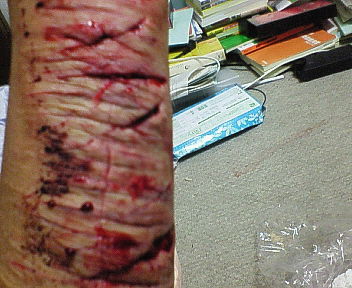 その結果 ﾘｽﾄｶｯﾄ画像があるのでﾔな人はみないで