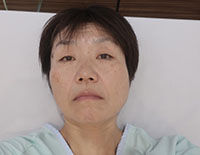 手術後酸素マスクが外れた