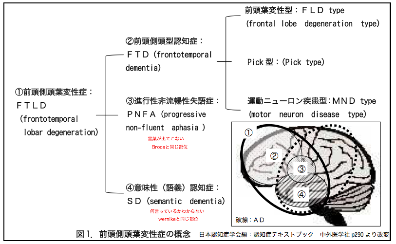 側 頭 認知 前頭 症 型