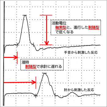 歯髄疾患