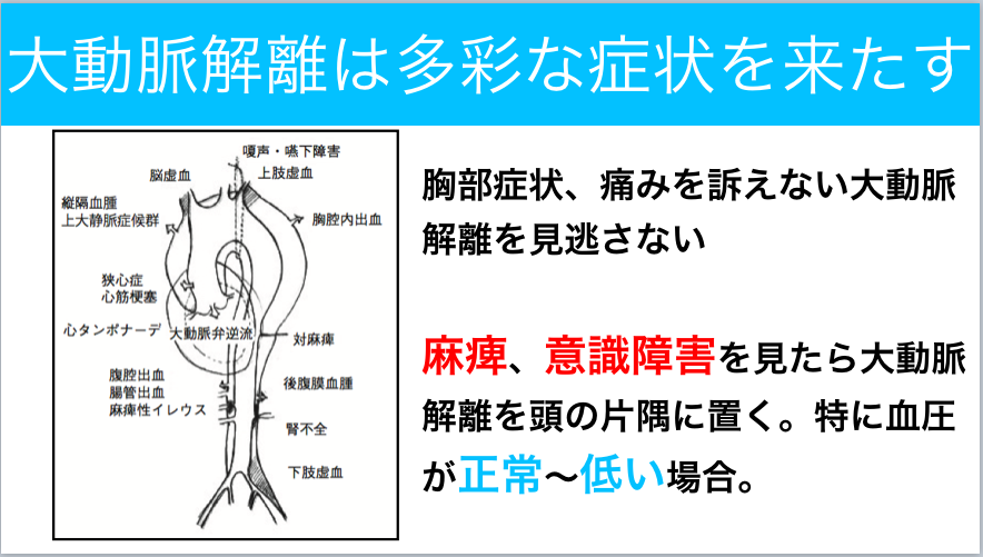 大動脈解離についてレクチャーしました 今日なに読もう 病院総合診療医の論文ブログ 大動脈解離についてレクチャーしました 今日なに読もう 病院総合診療医の論文ブログ