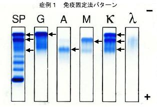 12_1c