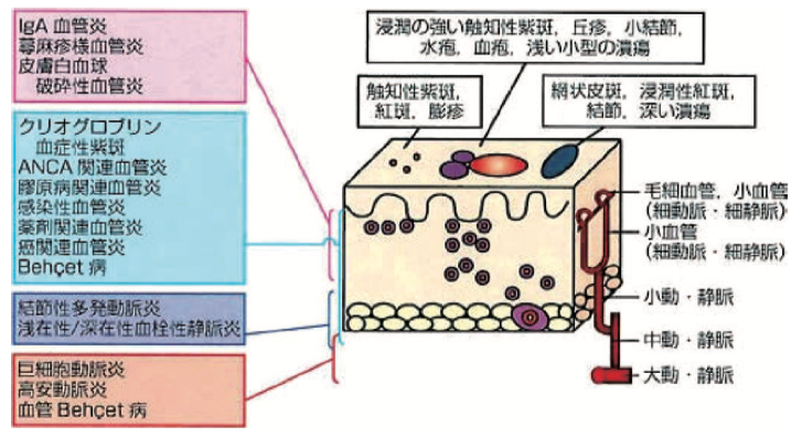 破砕性