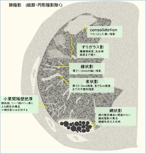 肺陰影