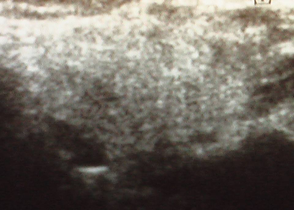 おたふくor反復性耳下腺炎?(1) : こどもの病気・おとなの病気