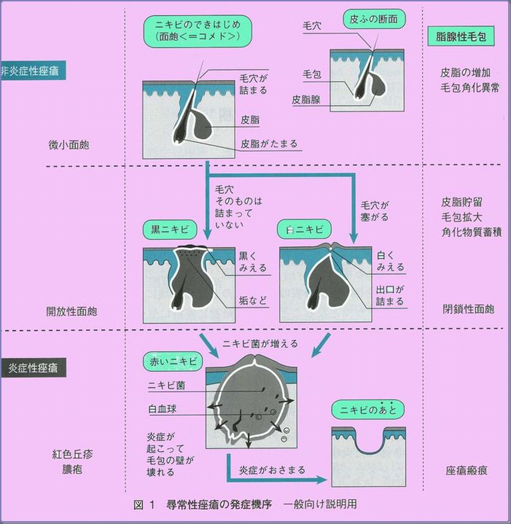 こどもの病気・おとなの病気:小児科疾患