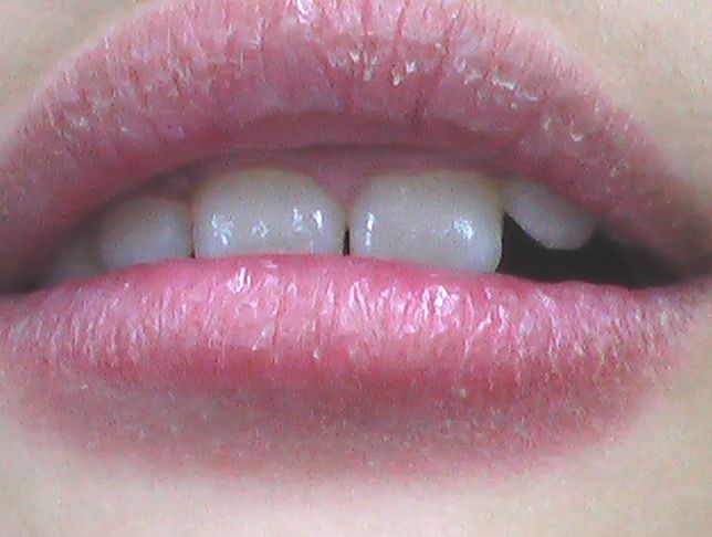 こどもの病気 おとなの病気 皮膚科疾患