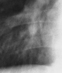 2026.4.3.lynphomanodule0000