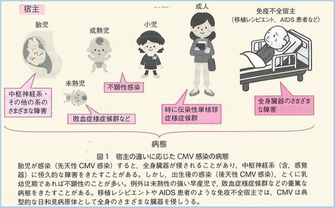 CMV