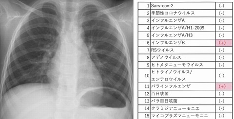 parainf (2)