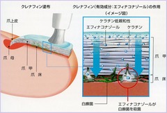 クレナフィン