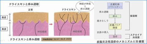 dryskin