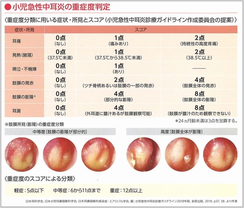 中耳炎