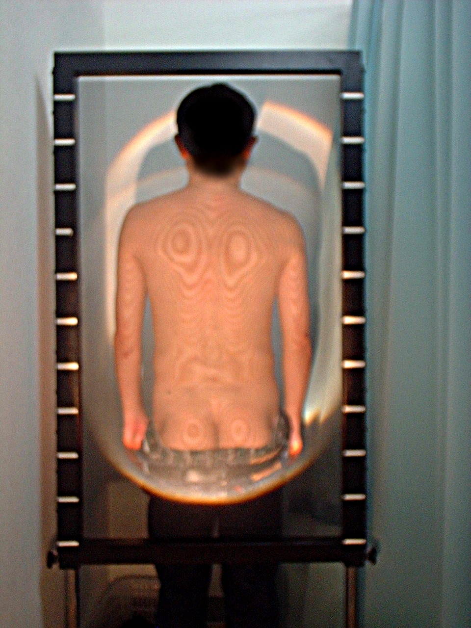 モアレ 検査 裸