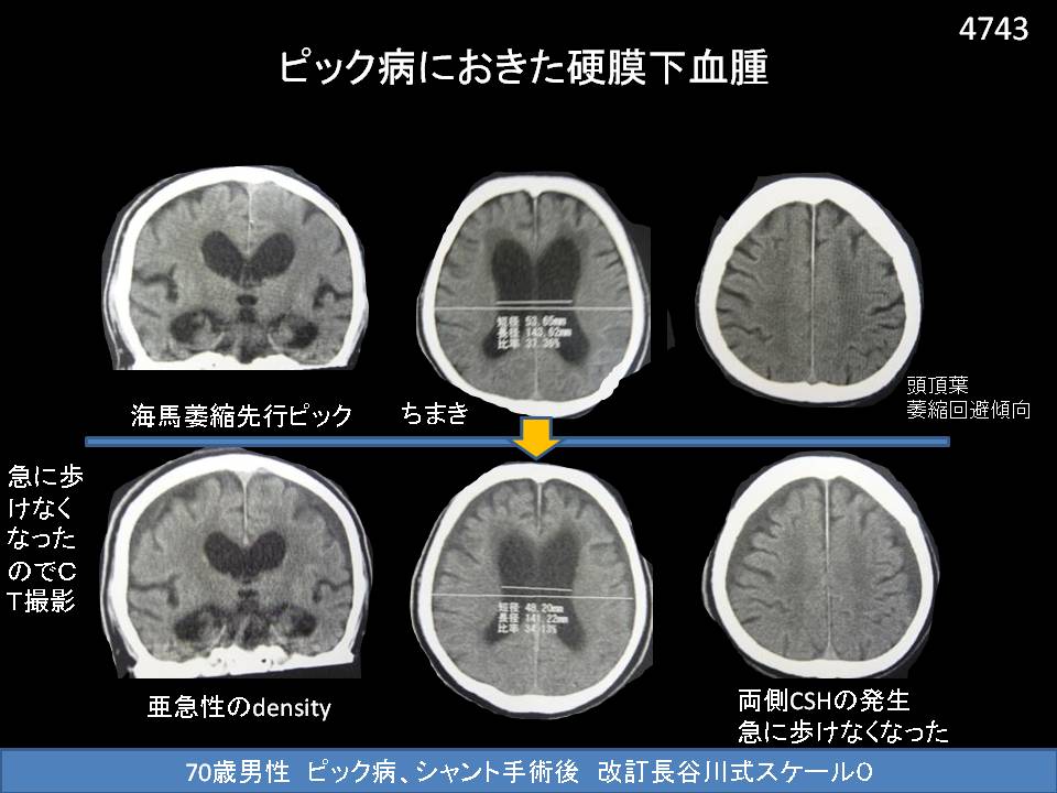 ドクターコウノの認知症ブログ