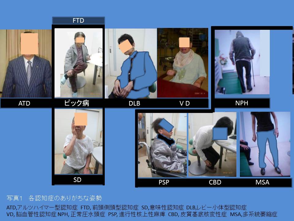  VDC の主な機能は何ですか?また、どのように機能しますか?