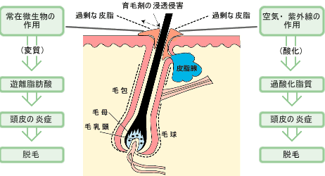断面図