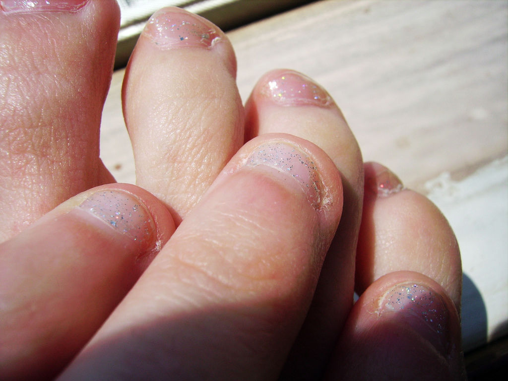 24 爪を噛む癖ってどう見える!?