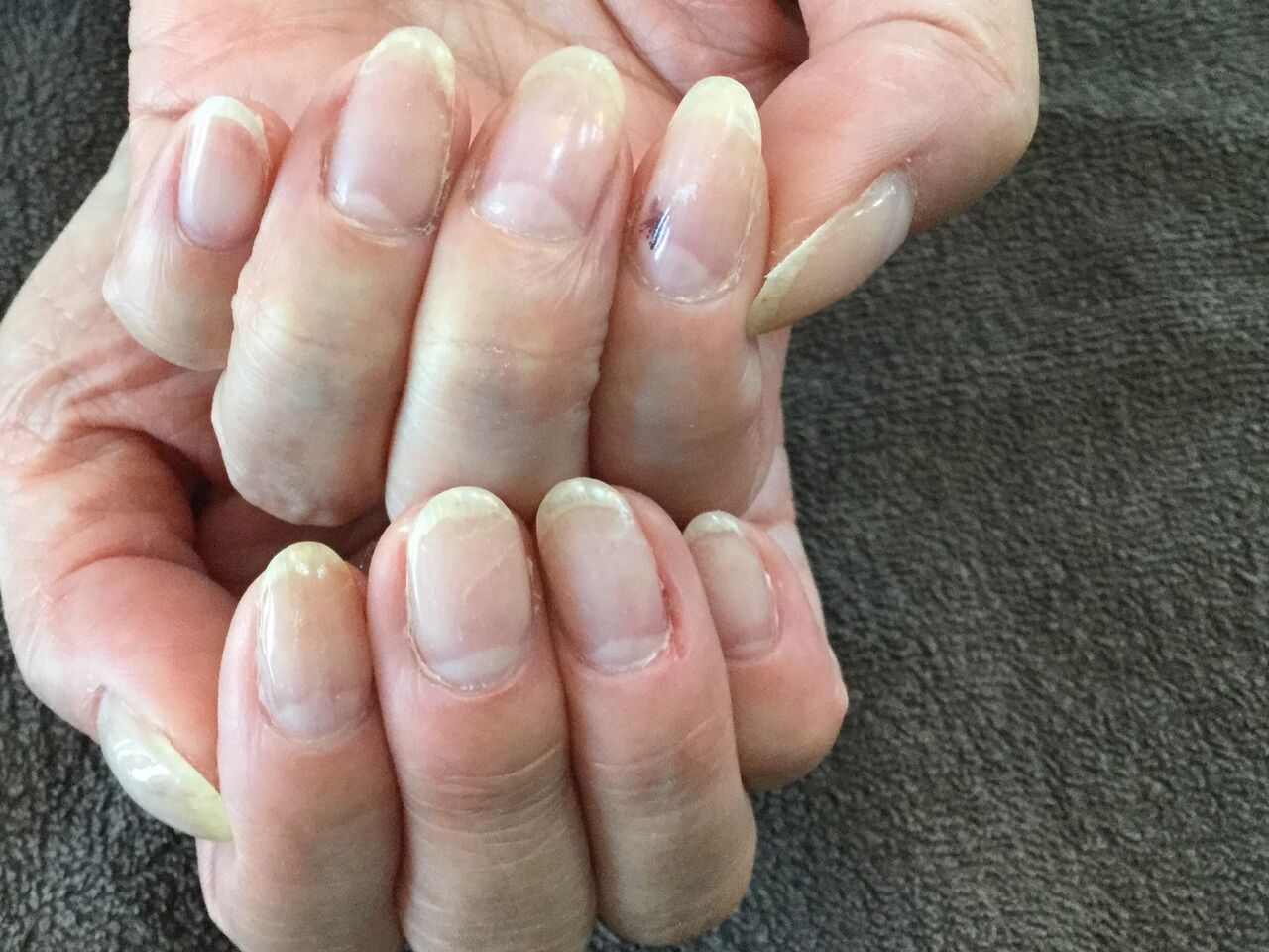 弱い自爪や折れやすい自爪の保護に クリア仕上げのフロータージェルネイル Nail Salon Freestyle