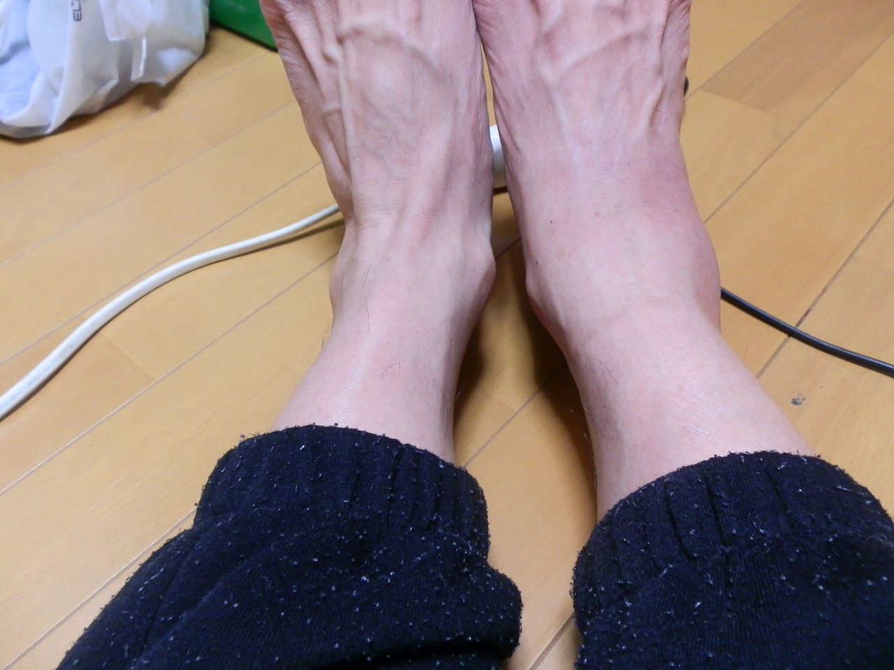 １０月２１日 朝１１時からド宴会 痛風アゲイン イーサン食堂日記 痛風になりました