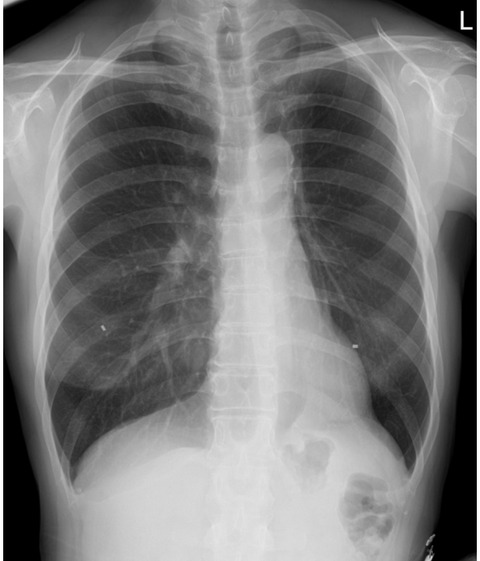 C33E0AB4-5DE8-4785-BDD6-0CD60AC1963B