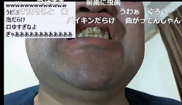 閲覧注意 1年ぶりに歯磨きしたら歯がヤバイことなってた 生主ニュース 閲覧注意 1年ぶりに歯磨きしたら歯がヤバイことなってた 生主ニュース